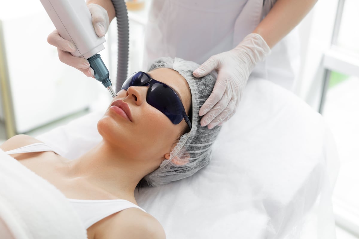 Mujer recibiendo tratamiento láser para rosácea y enrojecimiento facial
