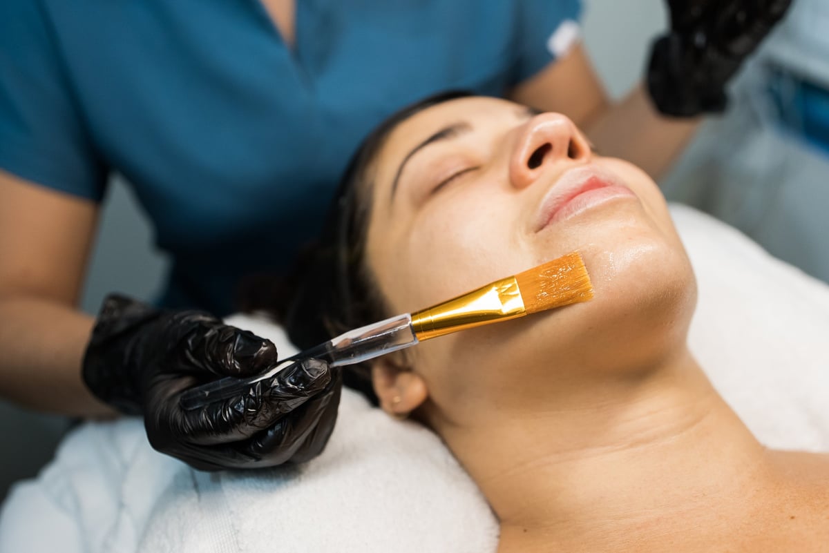 Woman getting a chemical peel procedure, improving skin texture at spa