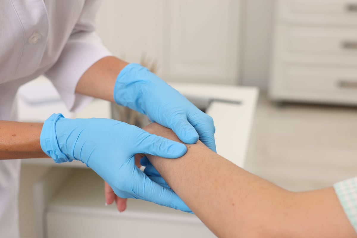Doctor examining young woman's mole in hospital, closeup