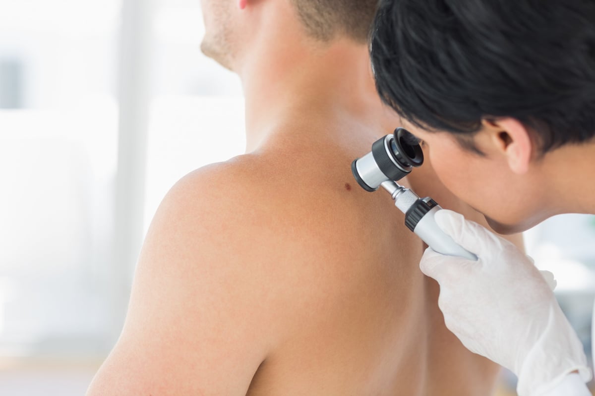 Female doctor examining mole on back of man in clinic